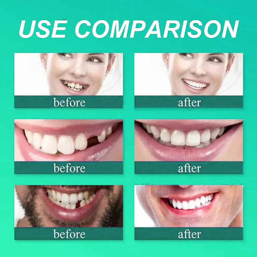 ✅ Made and Shipped from the UK| Smileasego™ Suction-fit Complete Denture 🍀