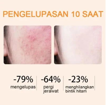 đ¸âBBOJI⢠Orange Enzyme Exfoliating Gel â The Gentle Miracle Your Skin Has Been Crying Out Forâđ¸