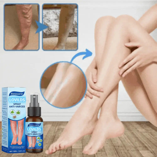 LOVILDS™ | Anti-Varicose Vein Spray