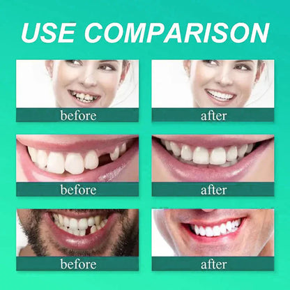 ✅ Made and Shipped from the UK| Smileasego™ Suction-fit Complete Denture 🍀